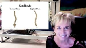 Pilates and Scoliosis with Sonjé Mayo